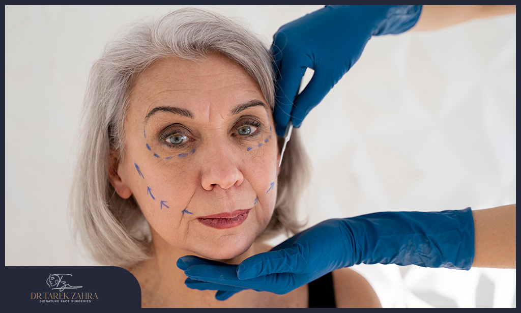 Surgical-Scar-After-Facelift
