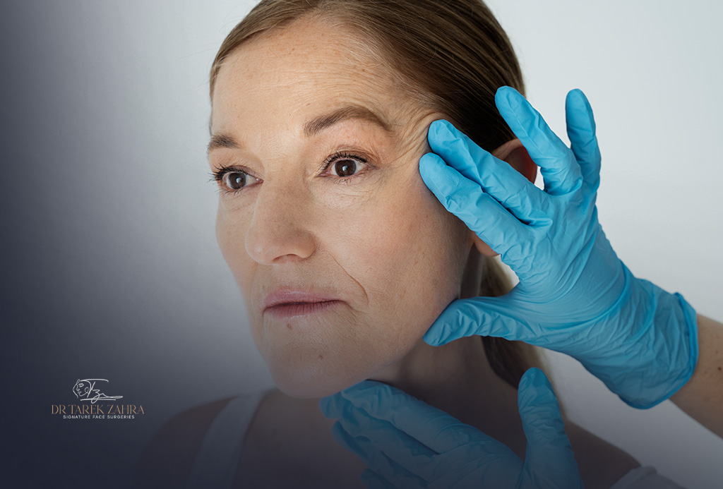 Endoscopic-Facelift