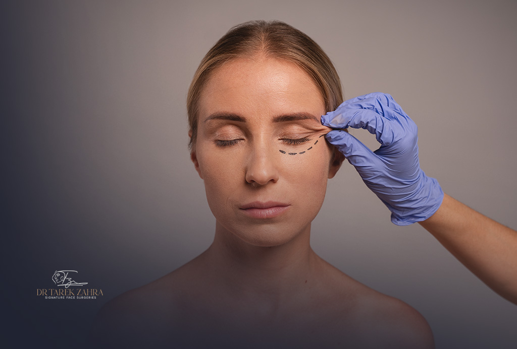 Eyelid-Lift-Surgery