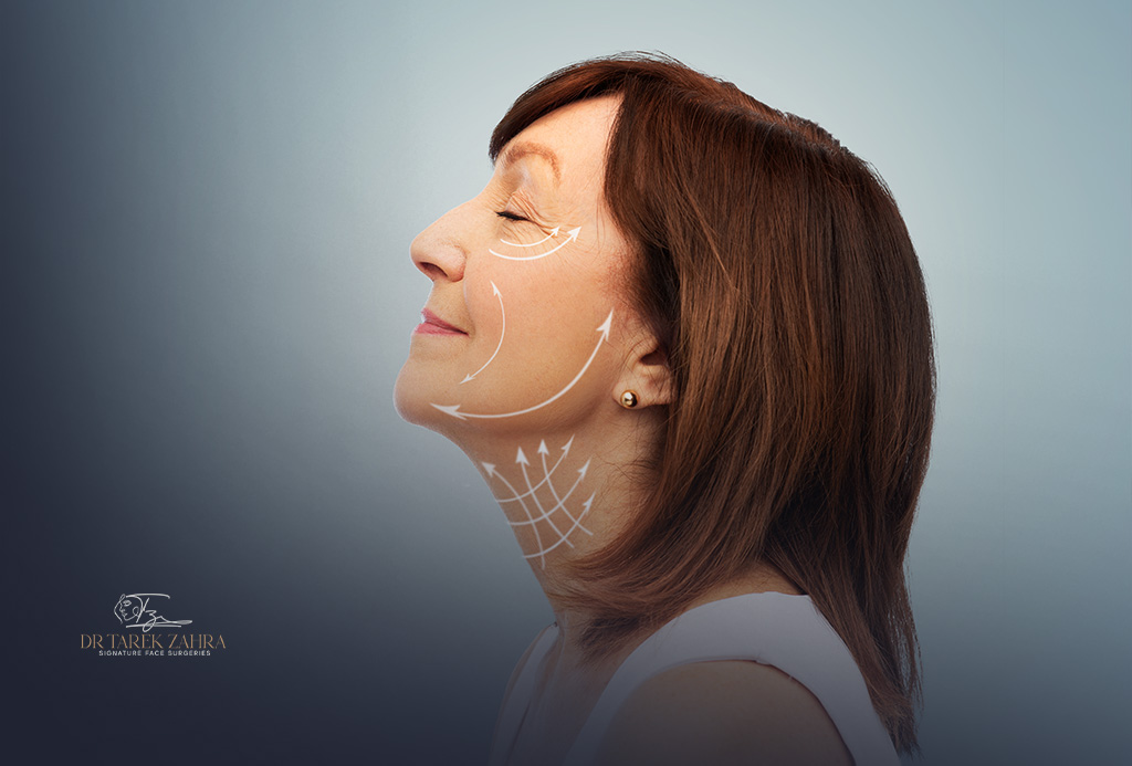 Permanent-Filler-Removal-with-Extended-Deep-Facelift-and-Neck-Lift