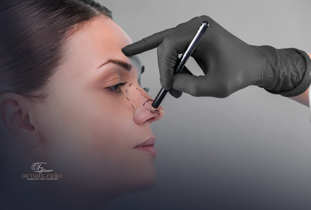 Rhinoplasty